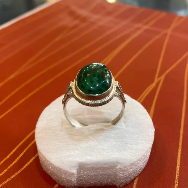 Real Kidney Stone Ring